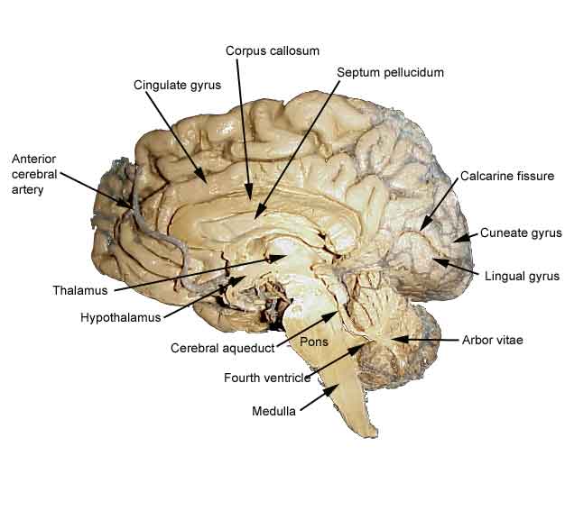 Midsagittal Brain Section